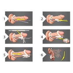 Extenseur de pénis Noir